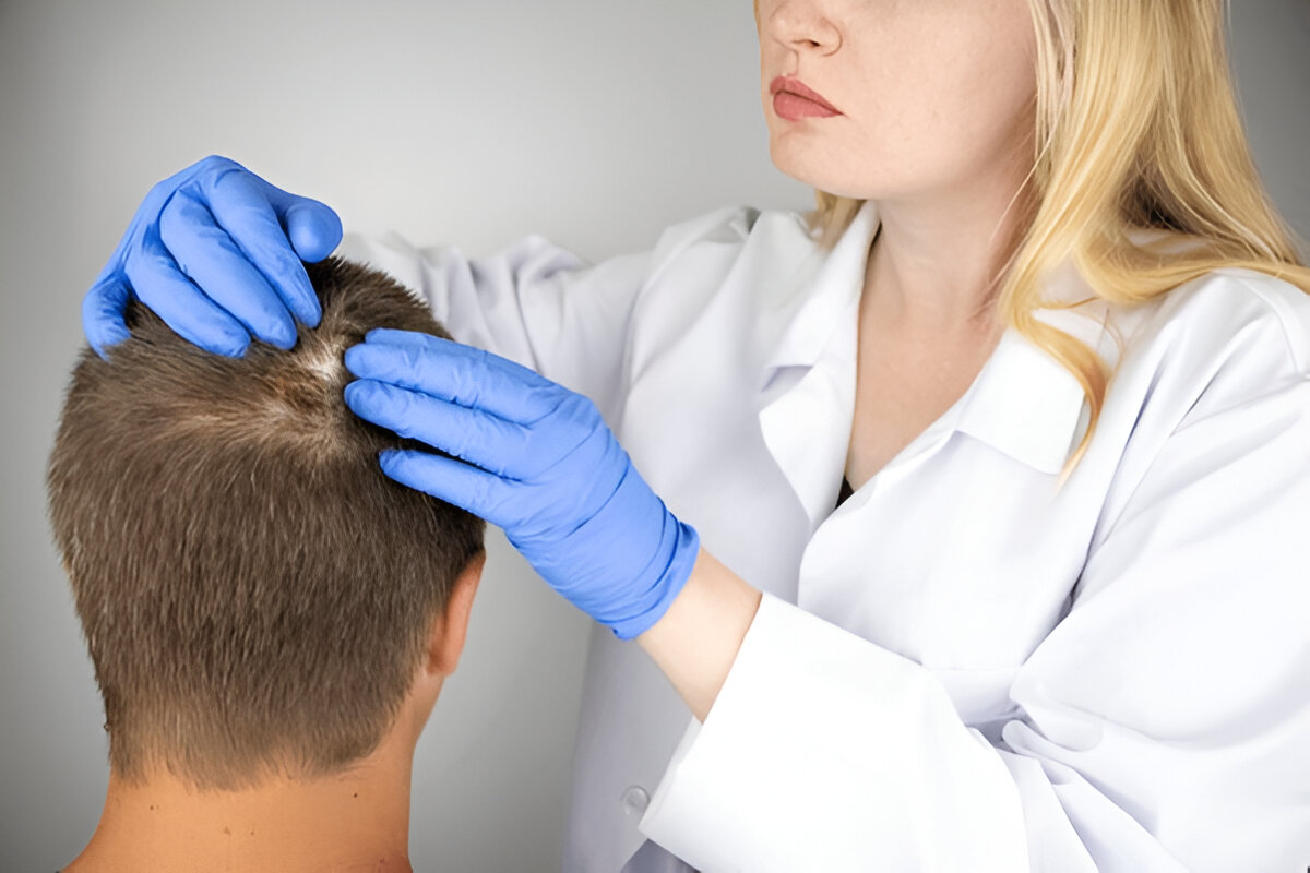 best hair transplant UK