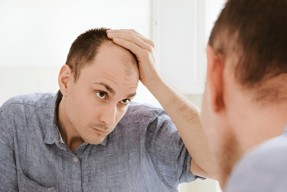 Hair Transplant