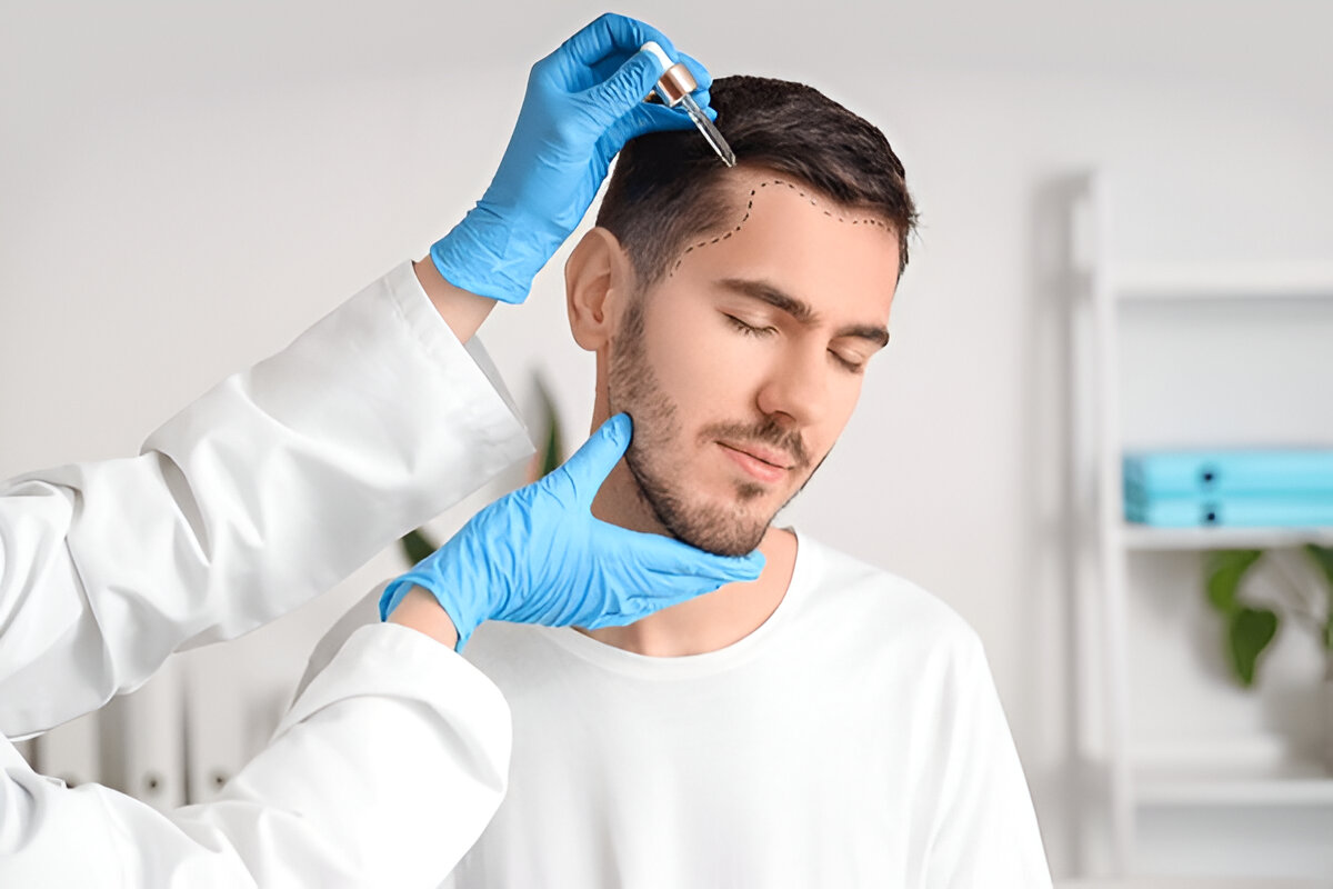 Hair Transplant
