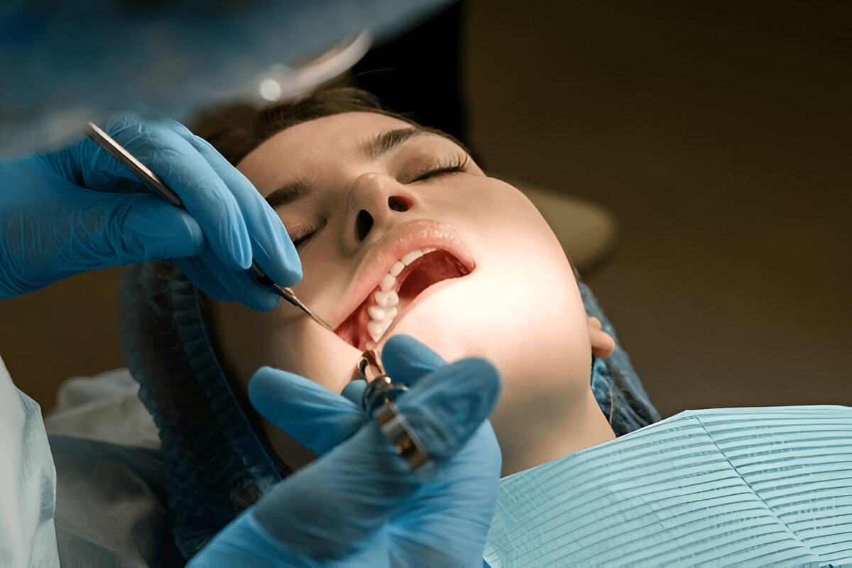 wisdom teeth surgery Miami